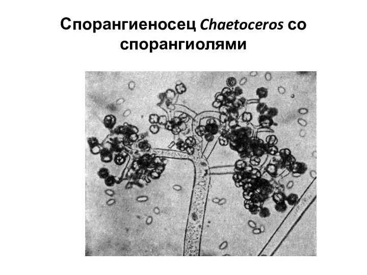 Спорангиеносец Chaetoceros со спорангиолями