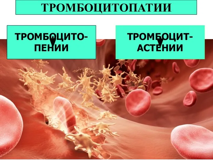 ТРОМБОЦИТОПАТИИ ТРОМБОЦИТО- ПЕНИИ ТРОМБОЦИТ- АСТЕНИИ