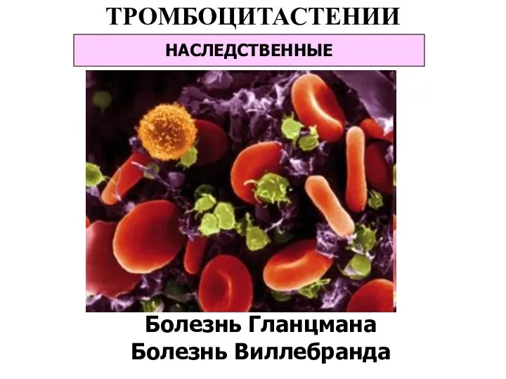 ТРОМБОЦИТАСТЕНИИ НАСЛЕДСТВЕННЫЕ Болезнь Гланцмана Болезнь Виллебранда