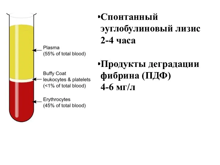 Спонтанный эуглобулиновый лизис 2-4 часа Продукты деградации фибрина (ПДФ) 4-6 мг/л