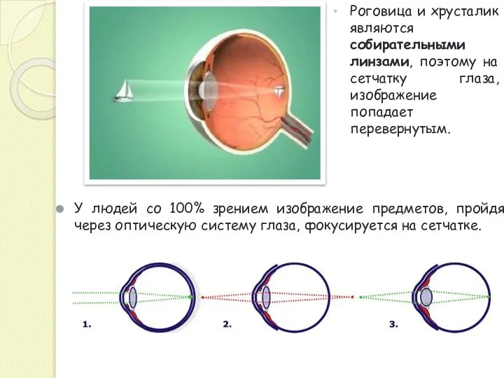 У людей со 100% зрением изображение предметов, пройдя через оптическую систему глаза,