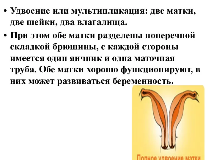 Удвоение или мультипликация: две матки, две шейки, два влагалища. При этом обе