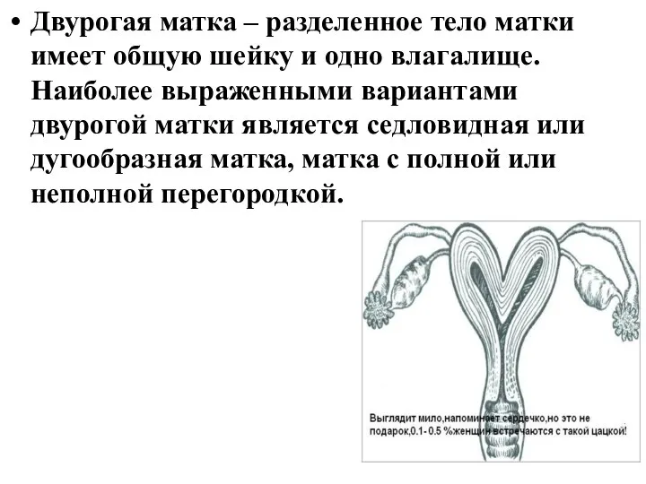 Двурогая матка – разделенное тело матки имеет общую шейку и одно влагалище.