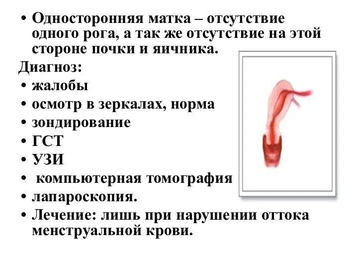 Односторонняя матка – отсутствие одного рога, а так же отсутствие на этой