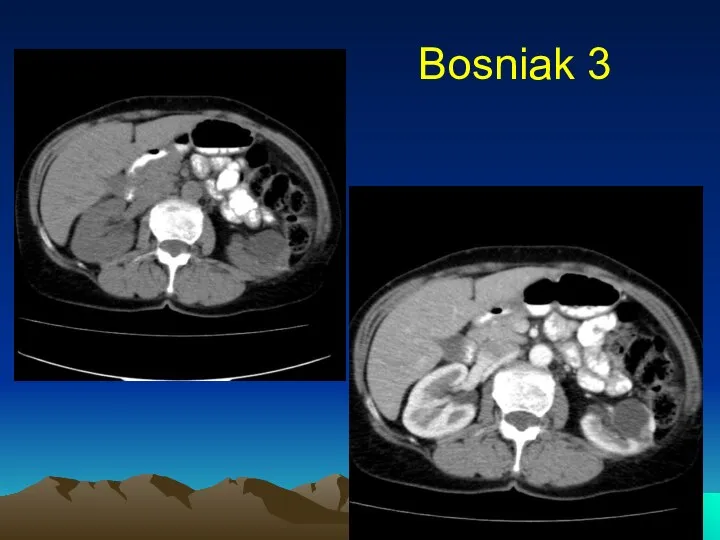 Bosniak 3