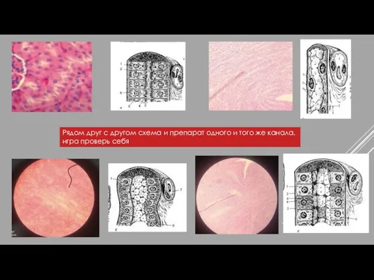 Рядом друг с другом схема и препарат одного и того же канала, игра проверь себя
