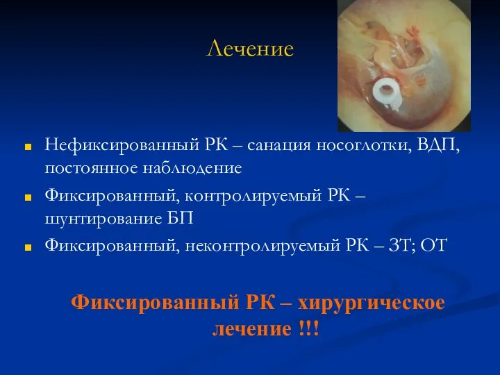 Лечение Нефиксированный РК – санация носоглотки, ВДП, постоянное наблюдение Фиксированный, контролируемый РК