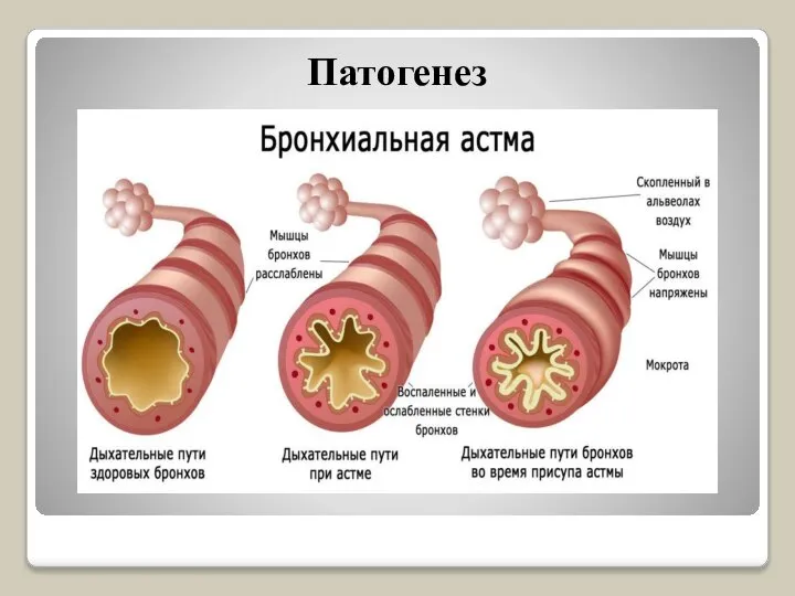 Патогенез