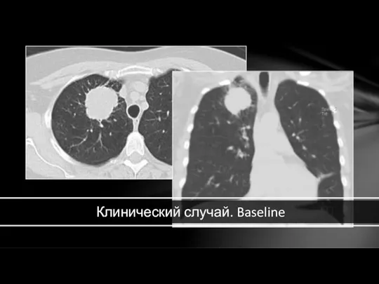 Клинический случай. Baseline