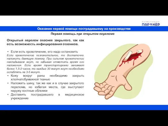 Оказание первой помощи пострадавшему на производстве Первая помощь при открытом переломе Открытый