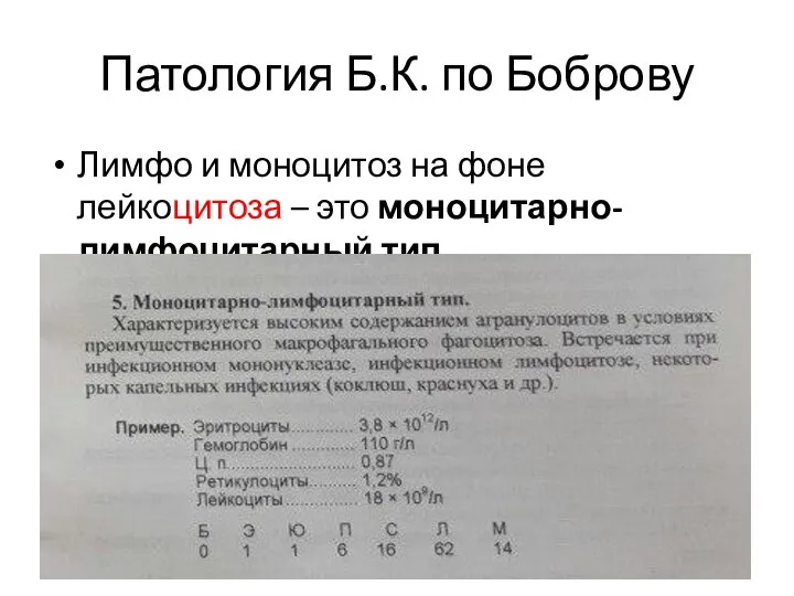 Патология Б.К. по Боброву Лимфо и моноцитоз на фоне лейкоцитоза – это моноцитарно-лимфоцитарный тип