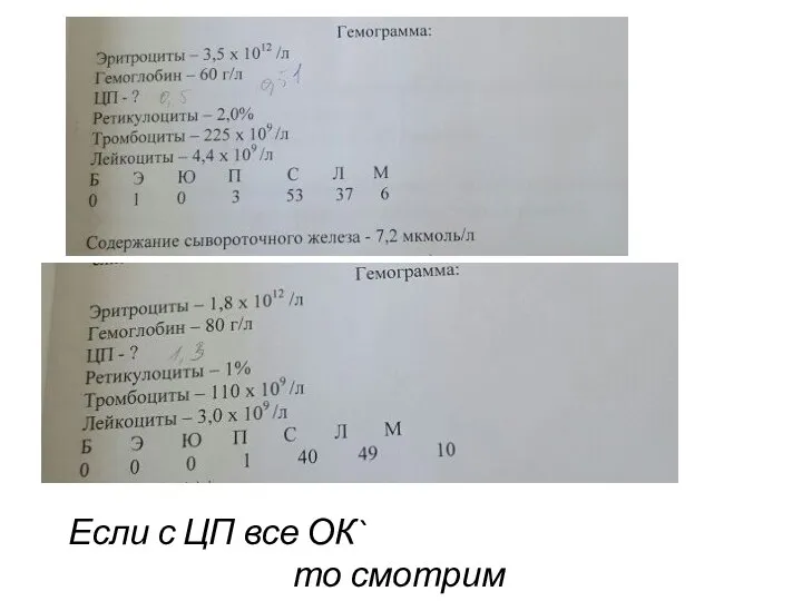 Если с ЦП все ОК` то смотрим ретикулоциты