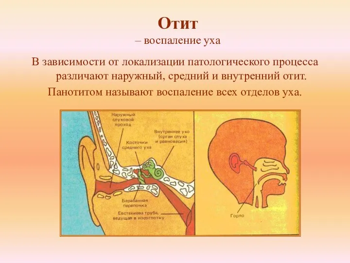 Отит – воспаление уха В зависимости от локализации патологического процесса различают наружный,