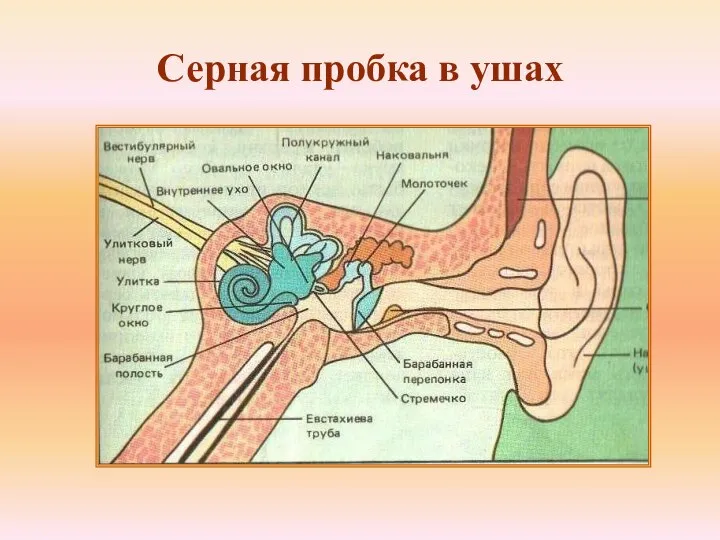 Серная пробка в ушах