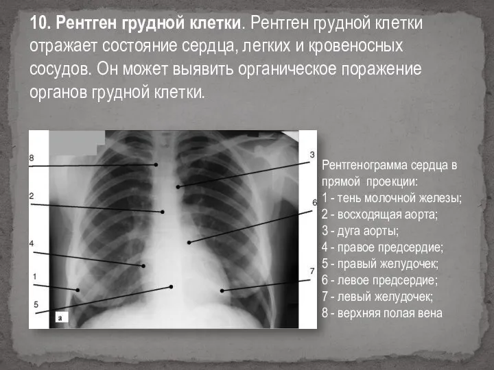 10. Рентген грудной клетки. Рентген грудной клетки отражает состояние сердца, легких и