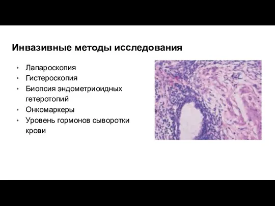 Инвазивные методы исследования Лапароскопия Гистероскопия Биопсия эндометриоидных гетеротопий Онкомаркеры Уровень гормонов сыворотки крови