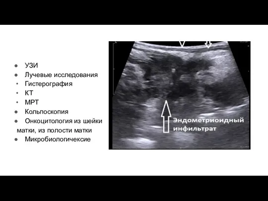 УЗИ Лучевые исследования Гистерография КТ МРТ Кольпоскопия Онкоцитология из шейки матки, из полости матки Микробиологичексие