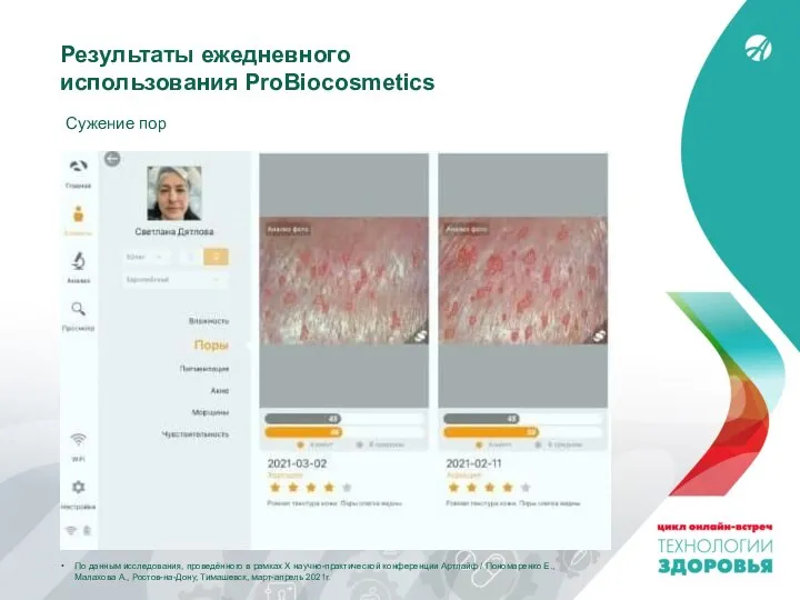 Результаты ежедневного использования ProBiocosmetics Сужение пор По данным исследования, проведённого в рамках