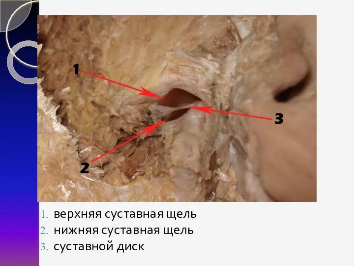 верхняя суставная щель нижняя суставная щель суставной диск