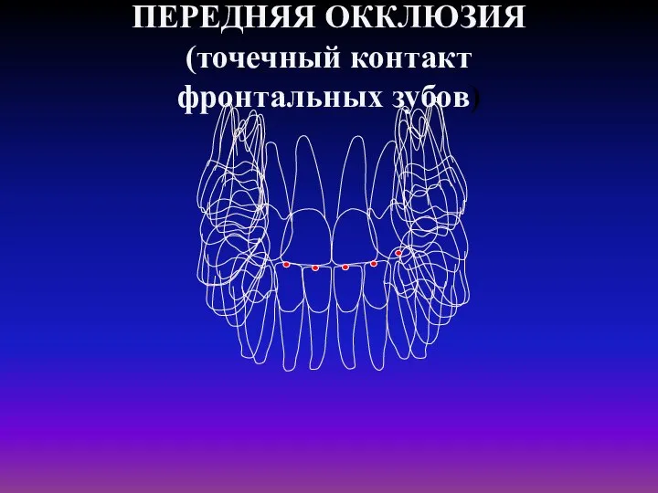 ПЕРЕДНЯЯ ОККЛЮЗИЯ (точечный контакт фронтальных зубов)