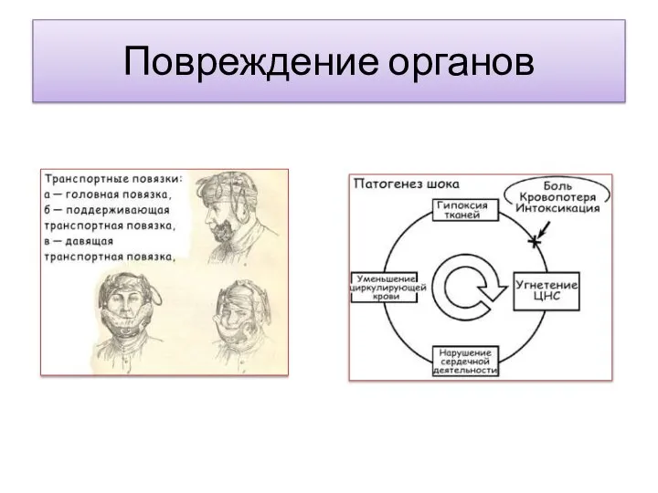 Повреждение органов