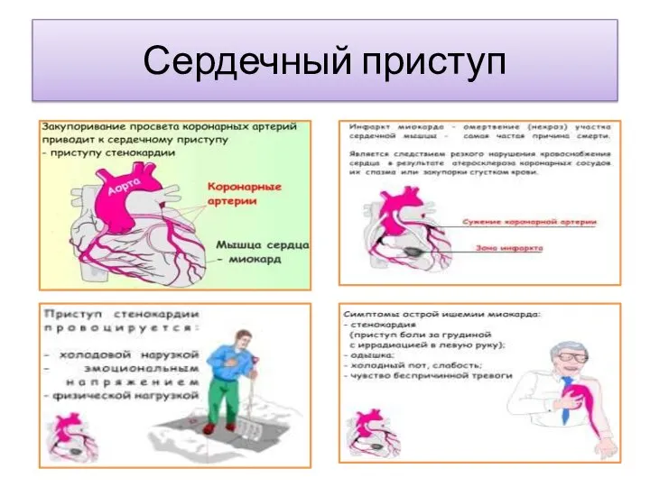 Сердечный приступ