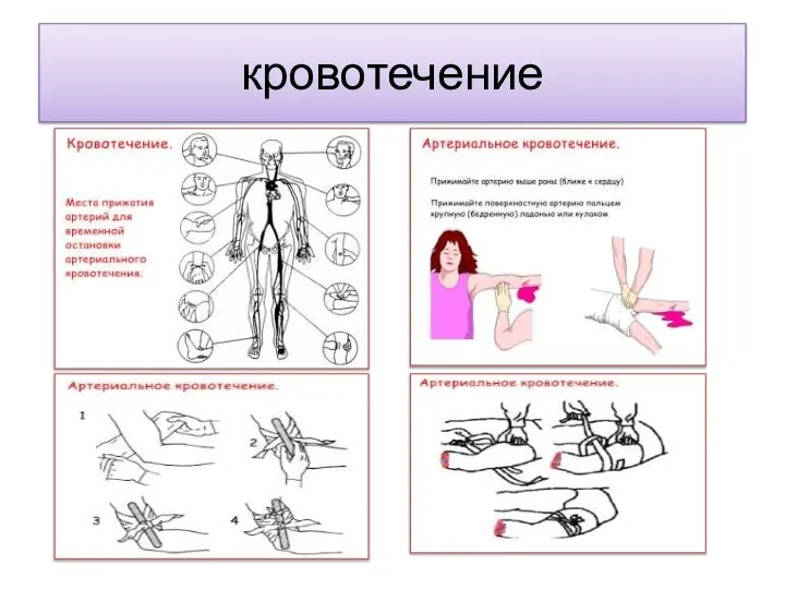 кровотечение