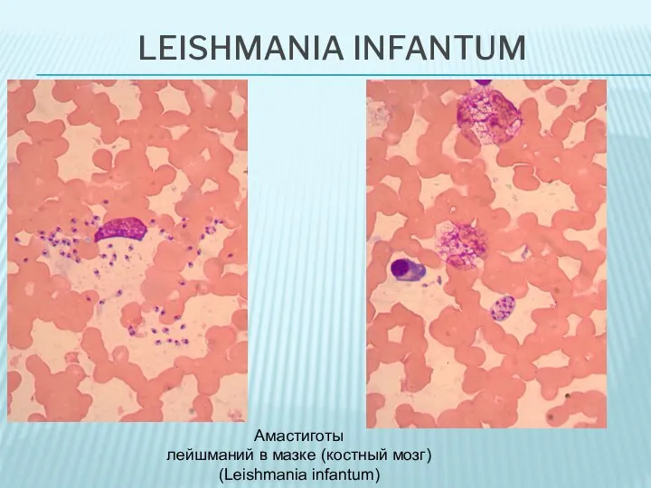 LEISHMANIA INFANTUM Амастиготы лейшманий в мазке (костный мозг) (Leishmania infantum)