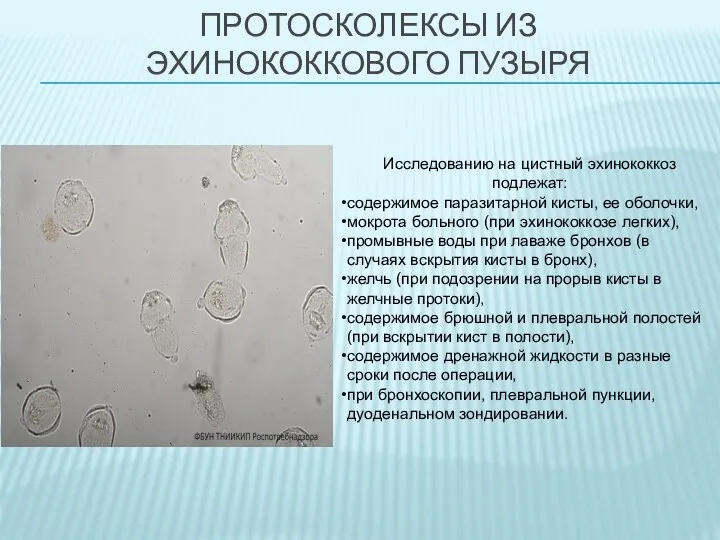 ПРОТОСКОЛЕКСЫ ИЗ ЭХИНОКОККОВОГО ПУЗЫРЯ Исследованию на цистный эхинококкоз подлежат: содержимое паразитарной ки­сты,