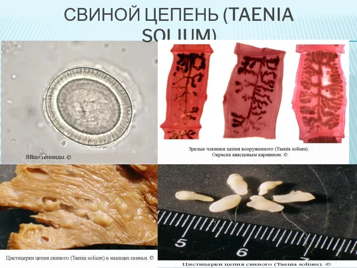 СВИНОЙ ЦЕПЕНЬ (TAENIA SOLIUM)