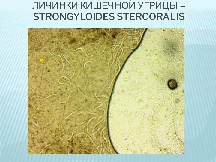 ЛИЧИНКИ КИШЕЧНОЙ УГРИЦЫ – STRONGYLOIDES STERCORALIS