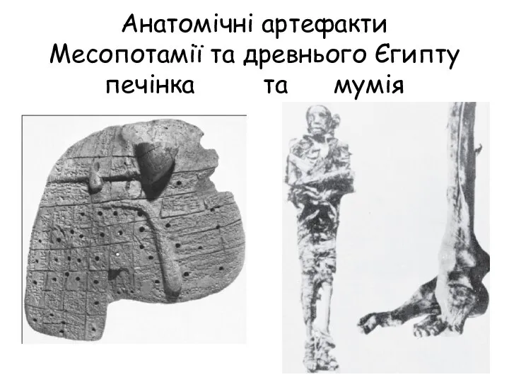 Анатомічні артефакти Месопотамії та древнього Єгипту печінка та мумія
