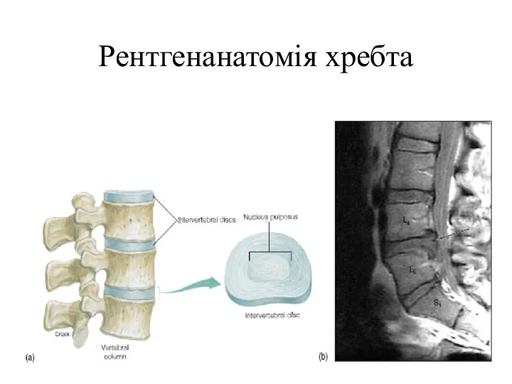 Рентгенанатомія хребта