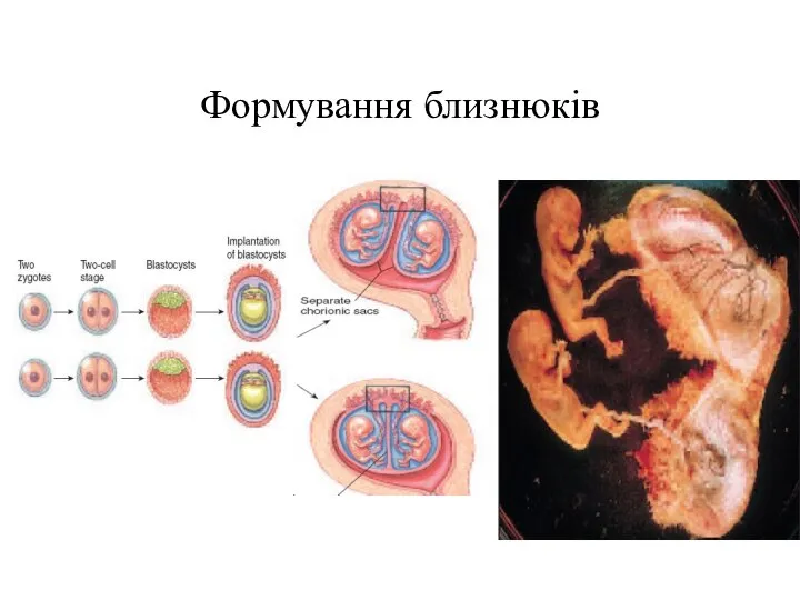 Формування близнюків