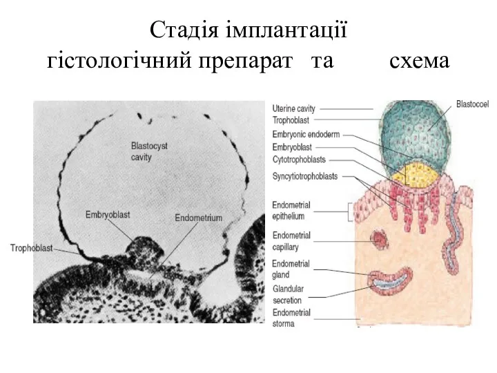 Стадія імплантації гістологічний препарат та схема