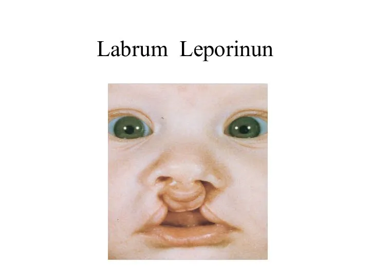 Labrum Leporinun