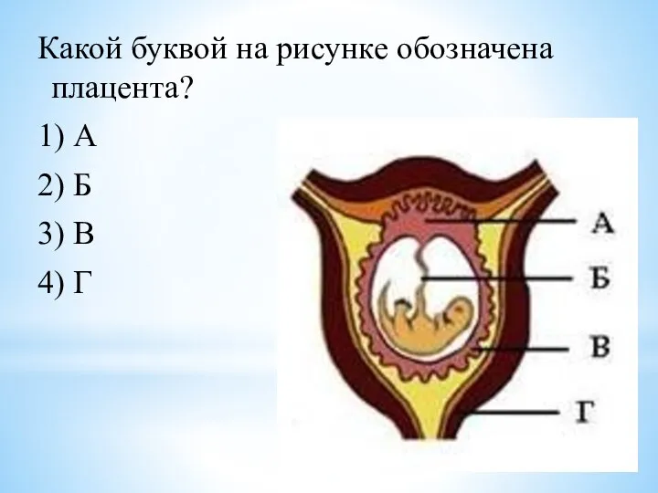 Какой буквой на рисунке обозначена плацента? 1) А 2) Б 3) В 4) Г