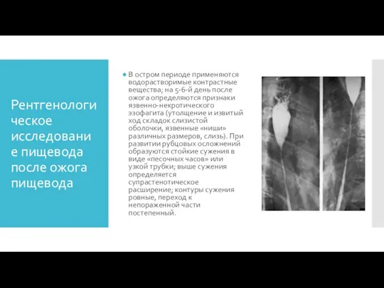 Рентгенологическое исследование пищевода после ожога пищевода В остром периоде применяются водорастворимые контрастные