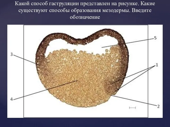 Какой способ гаструляции представлен на рисунке. Какие существуют способы образования мезодермы. Введите обозначение