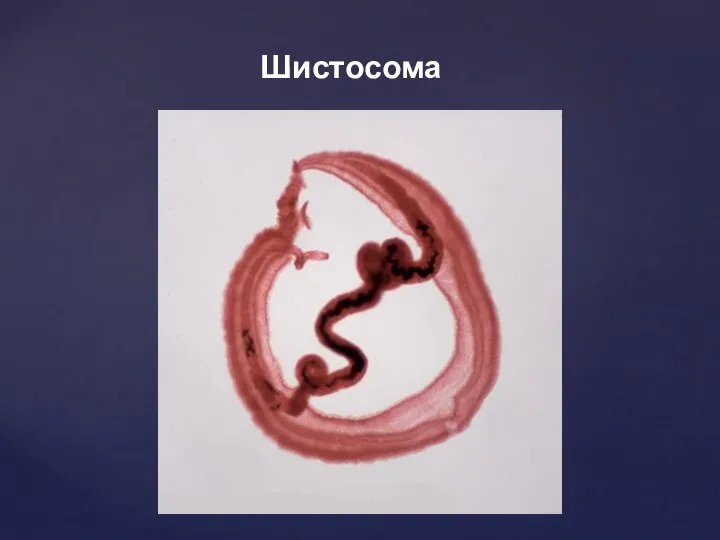 Шистосома