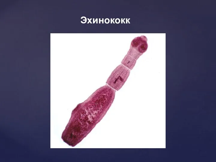 Эхинококк