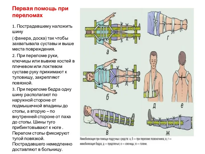 Первая помощь при переломах 1. Пострадавшему наложить шину ( фанера, доска) так