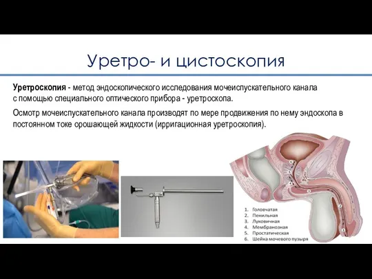 Уретро- и цистоскопия Уретроскопия - метод эндоскопического исследования мочеиспускательного канала с помощью