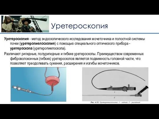 Уретероскопия Уретероскопия - метод эндоскопического исследования мочеточника и полостной системы почки (уретеропиелоскопия)