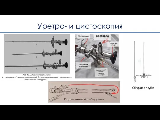 Уретро- и цистоскопия Обтуратор и тубус