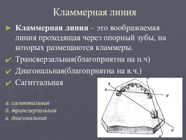 Кламмерная линия Кламмерная линия – это воображаемая линия проходящая через опорный зубы,