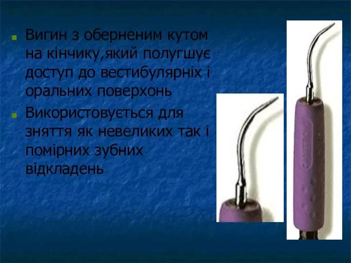 Вигин з оберненим кутом на кінчику,який полугшує доступ до вестибулярніх і оральних