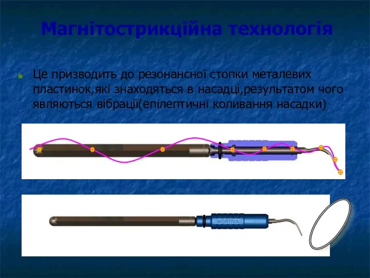 Магнітострикційна технологія Це призводить до резонансної стопки металевих пластинок,які знаходяться в насадці,результатом