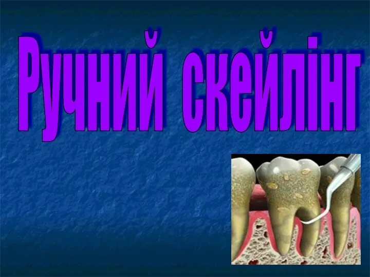 Ручний скейлінг