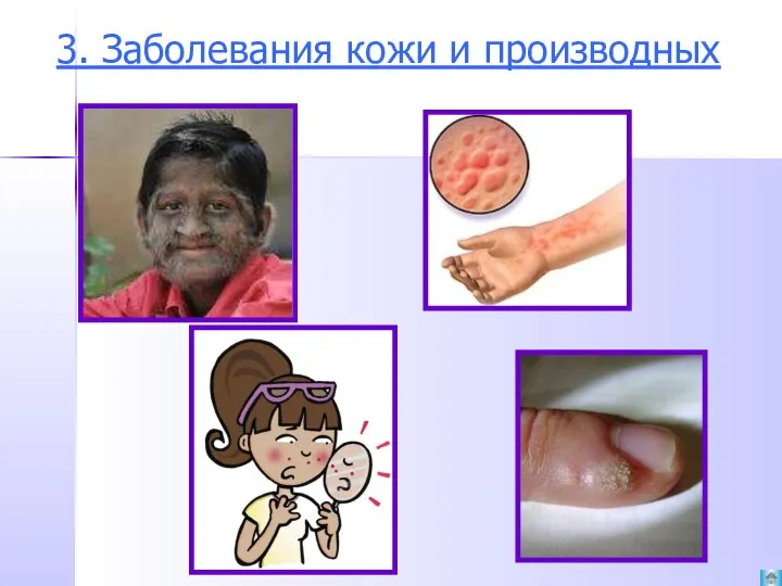 3. Заболевания кожи и производных